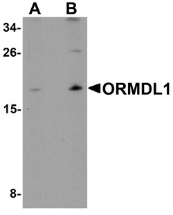 ProSci&nbsp;ORMDL1 Peptide