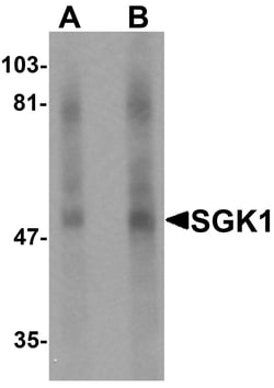 ProSci&nbsp;SGK1 Peptide