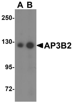ProSci&nbsp;AP3B2 Peptide