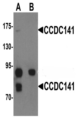 ProSci&nbsp;CCDC141 Peptide