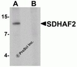 ProSci&nbsp;SDHAF2 Peptide