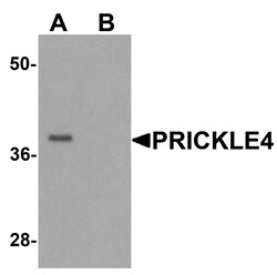 ProSci&nbsp;PRICKLE4 Peptide