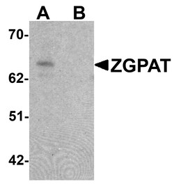 ProSci&nbsp;ZGPAT Peptide