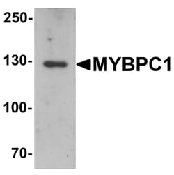 ProSci&nbsp;MYBPC1 Peptide