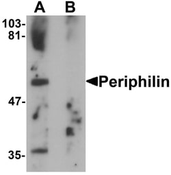 ProSci&nbsp;Periphilin Peptide