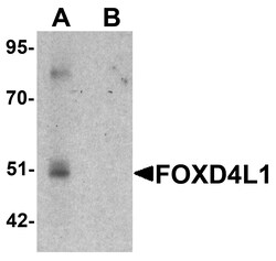 ProSci&nbsp;FOXD4L1 Peptide