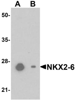 ProSci&nbsp;NKX2-6 Peptide