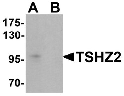 ProSci&nbsp;TSHZ2 Peptide
