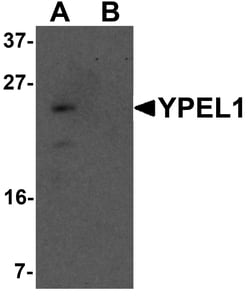 ProSci&nbsp;YPEL1 Peptide
