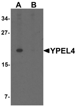 ProSci&nbsp;YPEL4 Peptide