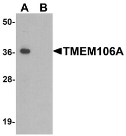ProSci&nbsp;TMEM106A Peptide