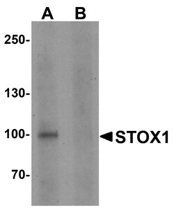 ProSci&nbsp;STOX1 Peptide