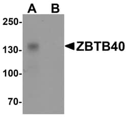 ProSci&nbsp;ZBTB40 Peptide