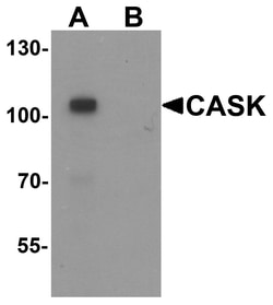 ProSci&nbsp;CASK Peptide