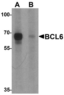ProSci&nbsp;BCL6 Peptide