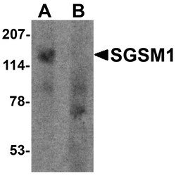 ProSci&nbsp;SGSM1 Peptide