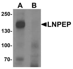 ProSci&nbsp;LNPEP Peptide