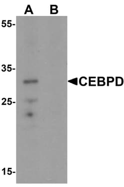 ProSci&nbsp;CEBPD Peptide