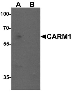 ProSci&nbsp;CARM1 Peptide