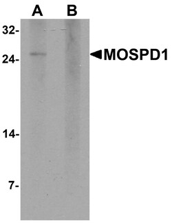ProSci&nbsp;MOSPD1 Peptide