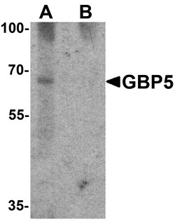 ProSci&nbsp;GBP5 Peptide