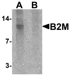 ProSci&nbsp;B2M Peptide