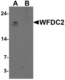 ProSci&nbsp;WFDC2 Peptide