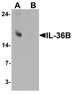ProSci&nbsp;IL-36B Peptide