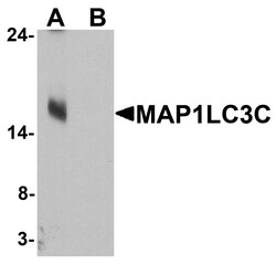 ProSci&nbsp;MAP1LC3C Peptide