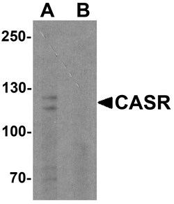 ProSci&nbsp;CASR Peptide