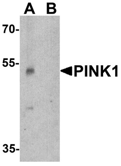 ProSci&nbsp;PINK1 Peptide