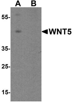 ProSci&nbsp;WNT5 Peptide