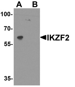 ProSci&nbsp;IKZF2 Peptide