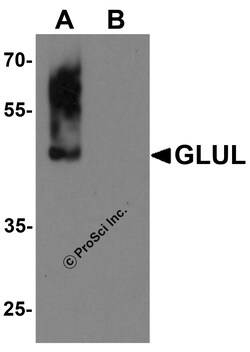 ProSci&nbsp;GLUL Peptide