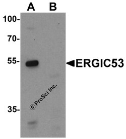 ProSci&nbsp;ERGIC53 Peptide