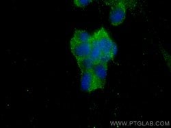 AP2A1 Rabbit anti-Human, Mouse, Polyclonal, Proteintech:Antibodies:Primary