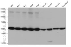 Annexin A11 Mouse anti-Human, Mouse, Rat, Rabbit, Pig, Clone: 1A3C4, Proteintech:Antibodies:Primary