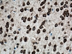 Proteintech Ataxin 2 Rabbit anti-Human, Mouse, Rat, Biotin, Polyclonal, Proteintech