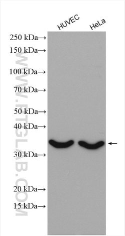 CTGF Rabbit anti-Human, Rat, Polyclonal, Proteintech 20 &mu;L; Unconjugated:Antibodies,