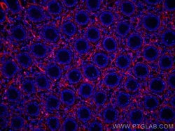 Collagen Type III (N-terminal) Rabbit anti-Human, CoraLite 594, Clone: 2O1, Proteintech