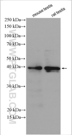 DMRT1 Rabbit anti-Human, Mouse, Rat, Polyclonal, Proteintech:Antibodies:Primary