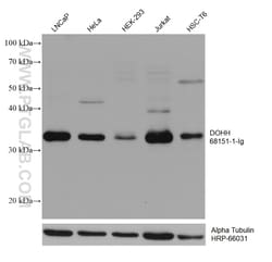 DOHH Mouse Monoclonal Antibody, Proteintech Unconjugated; 20 &mu;L:Antibodies,