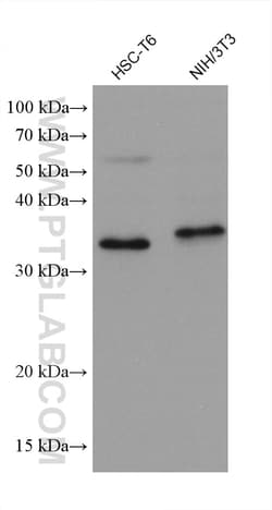 DOHH Mouse Monoclonal Antibody, Proteintech Unconjugated; 20 &mu;L:Antibodies,