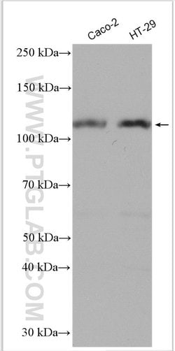 DPP4/CD26 Rabbit anti-Human, Polyclonal, Proteintech 20 &mu;L; Unconjugated:Antibodies,