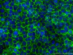 DPP4/CD26 Mouse Monoclonal Antibody, Proteintech Unconjugated; 20 &mu;L:Antibodies,