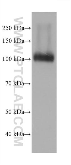 DPP4/CD26 Mouse Monoclonal Antibody, Proteintech Unconjugated; 20 &mu;L:Antibodies,