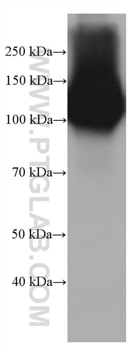 DPP4/CD26 Mouse Monoclonal Antibody, Proteintech Unconjugated; 20 &mu;L:Antibodies,