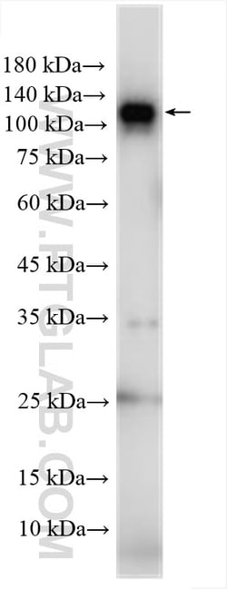 DPYD Rabbit Polyclonal Antibody, Proteintech Unconjugated; 20 &mu;L:Antibodies,
