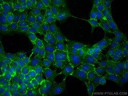 CoraLite Plus 488-conjugated DSG2 Rabbit Polyclonal Antibody, Proteintech:Antibodies:Primary