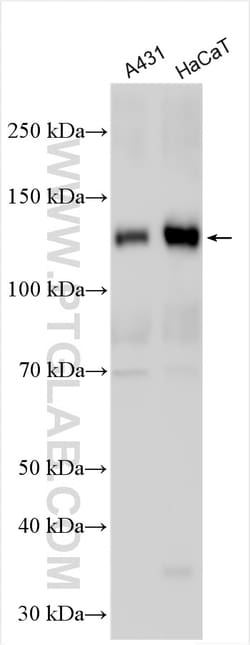 DSG3 Rabbit Polyclonal Antibody, Proteintech Unconjugated; 150 &mu;L:Antibodies,